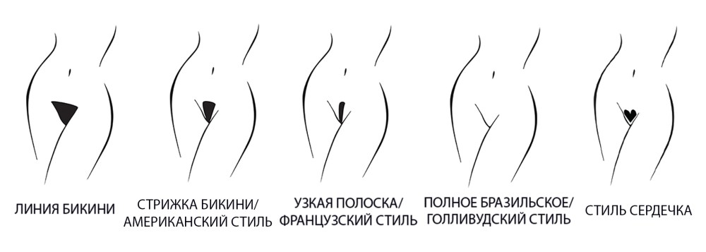 Интимная стрижка женские