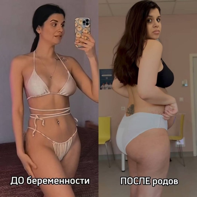 Фигура после родов