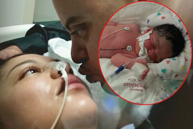 Premature baby